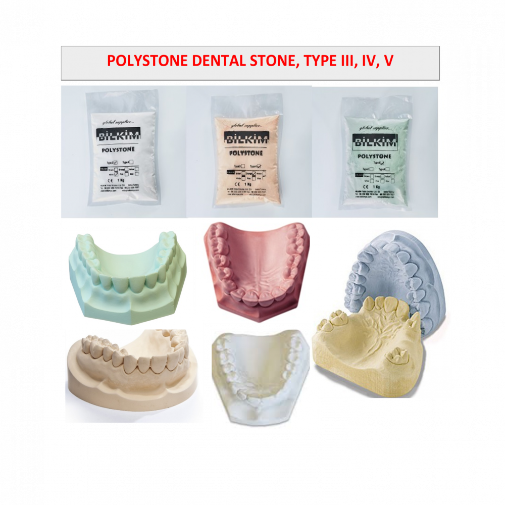 Dental stone